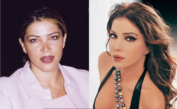 Arab Celebrities Before After